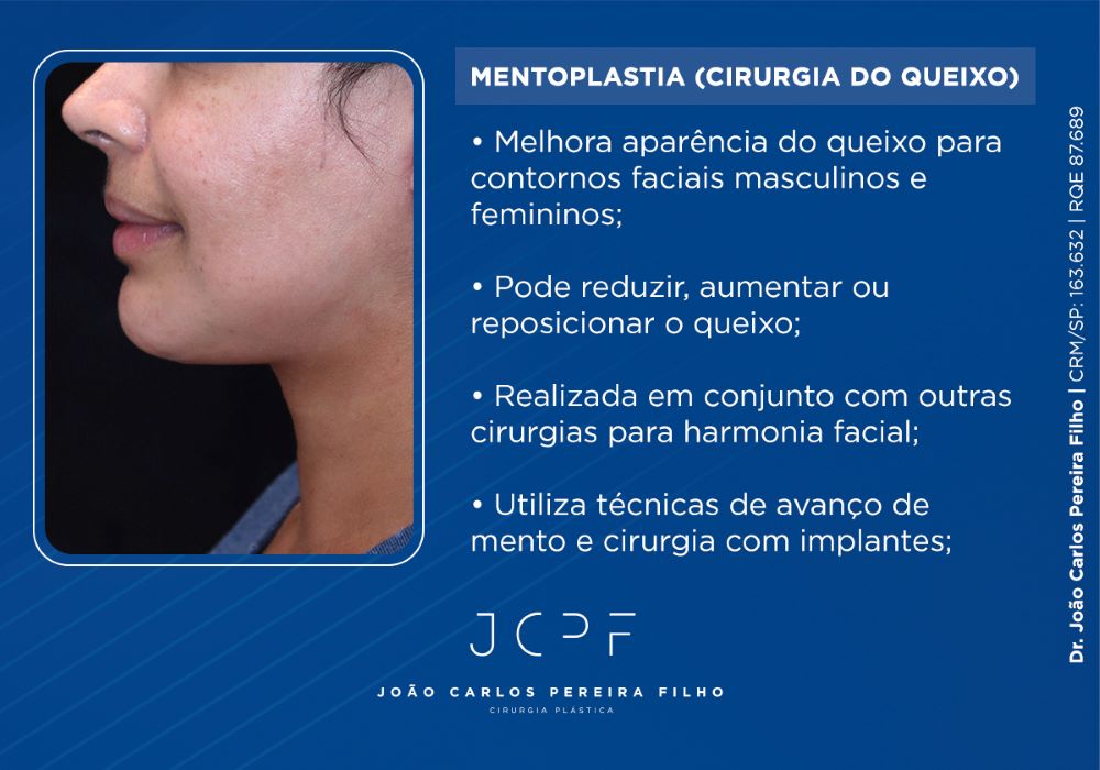 Neck Lift (Lifting de Pescoço)
Melhora aparência do queixo para contornos faciais masculinos e femininos;
Pode reduzir, aumentar ou reposicionar o queixo;
Realizada em conjunto com outras cirurgias para harmonia facial;
Utiliza técnicas de avanço de mento e cirurgia com implantes;
Recuperação com pouco inchaço e desconforto;
Melhora dos contornos faciais logo após a cirurgia.
