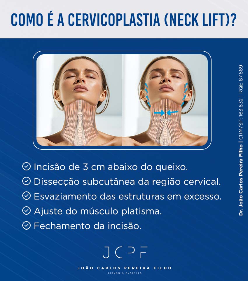 Como é a Cervicoplastia (Neck Lift)?
> Incisão de 3 cm abaixo do queixo.
> Dissecção subcutânea da região cervical.
> Esvaziamento das estruturas em excesso.
> Ajuste do músculo platisma.
> Fechamento da incisão.
