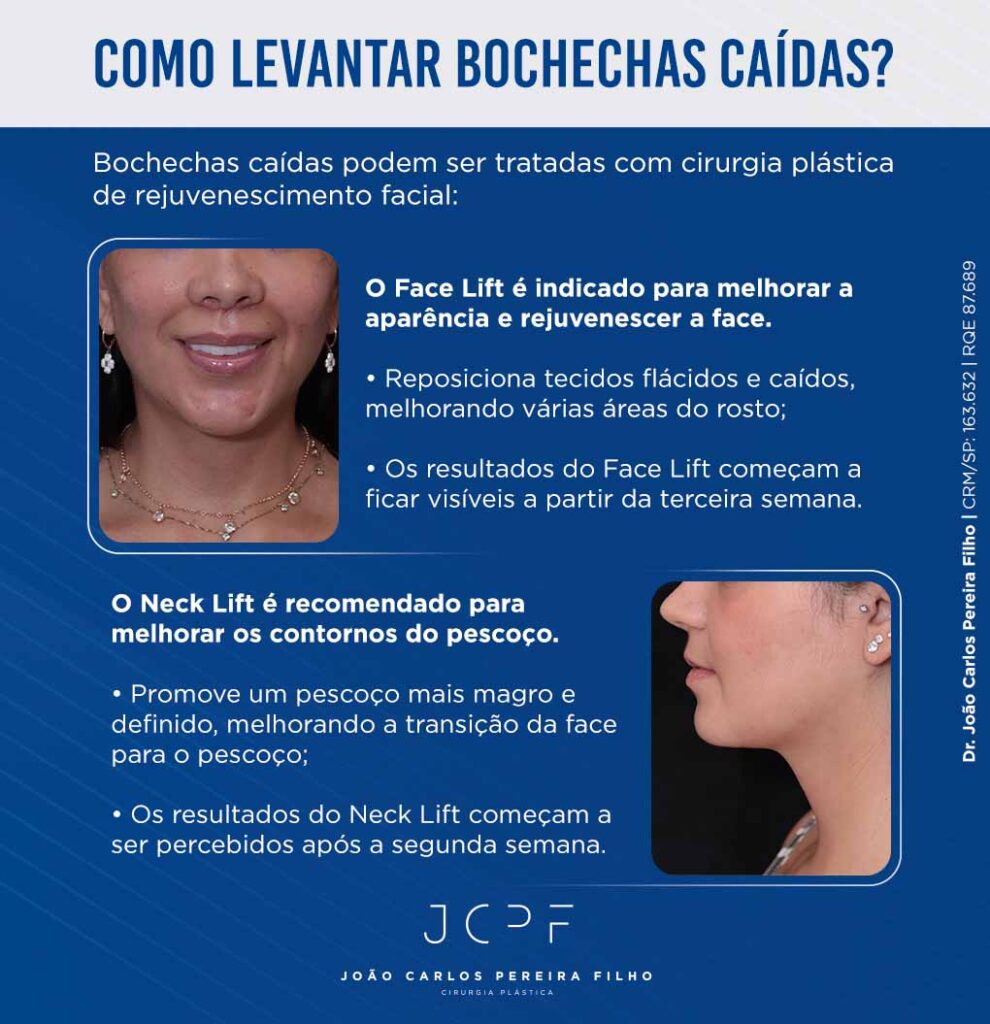 Como levantar bochechas caídas? Bochechas caídas podem ser tratadas com cirurgia plástica de rejuvenescimento facial: O Face Lift é indicado para melhorar a aparência e rejuvenescer a face. Reposiciona tecidos flácidos e caídos, melhorando várias áreas do rosto; Os resultados do Face Lift começam a ficar visíveis a partir da terceira semana. O Neck Lift é recomendado para melhorar os contornos do pescoço. Promove um pescoço mais magro e definido, melhorando a transição da face para o pescoço; Os resultados do Neck Lift começam a ser percebidos após a segunda semana.