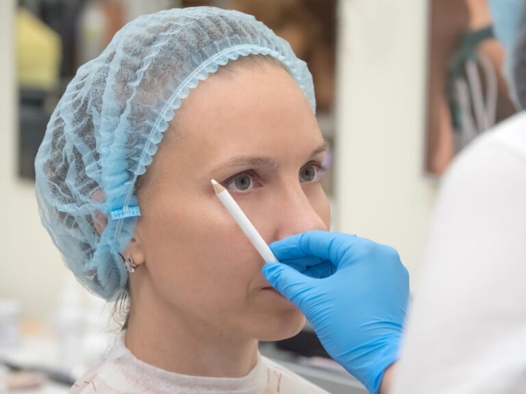 Paciente mulher com touca cirúrgica azul em preparo para cirurgia de Brow Lift, enquanto cirurgião plástico realiza marcação pré-operatória com lápis dermográfico na região do nariz e sobrancelha em ambiente hospitalar.