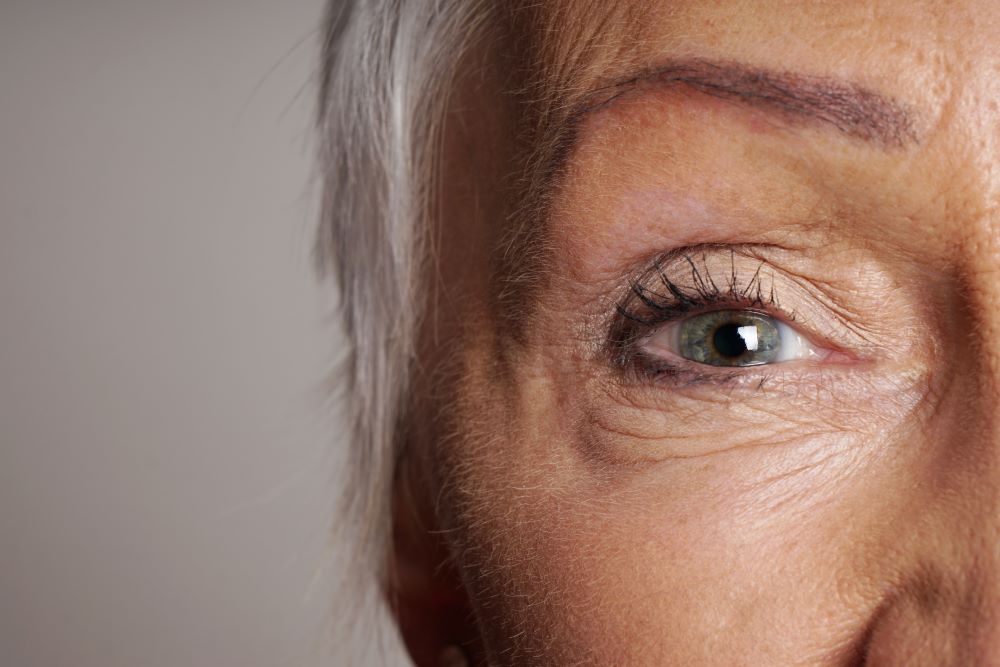 Close-up da região dos olhos de uma mulher madura, evidenciando uma discreta bolsa nos olhos, linhas finas e sinais naturais do envelhecimento facial, ilustrando um tema relacionado ao rejuvenescimento do olhar e tratamentos estéticos para a região periocular.